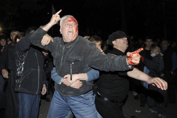 Zraněný demonstrant v Tbilisi.